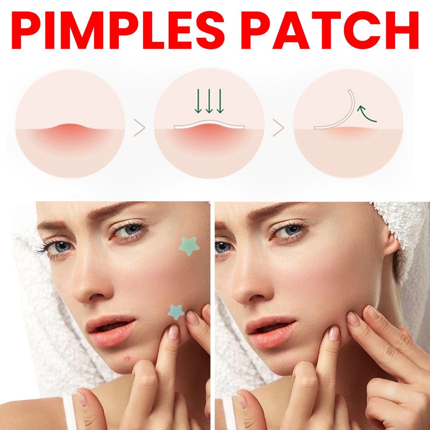 Fylie™ Desalting Pimple Spot Skin Repair Patch